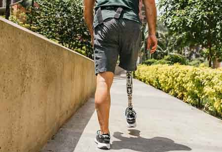 Advancing Mobility and Independence with Lower Limb Amputation Solutions