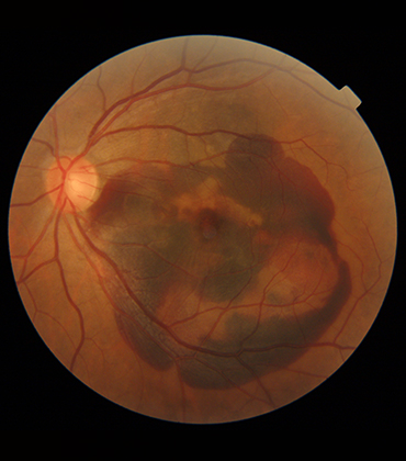 ., Topcon Healthcare | Agri Business Review | Eye Care Diagnostic Solutions